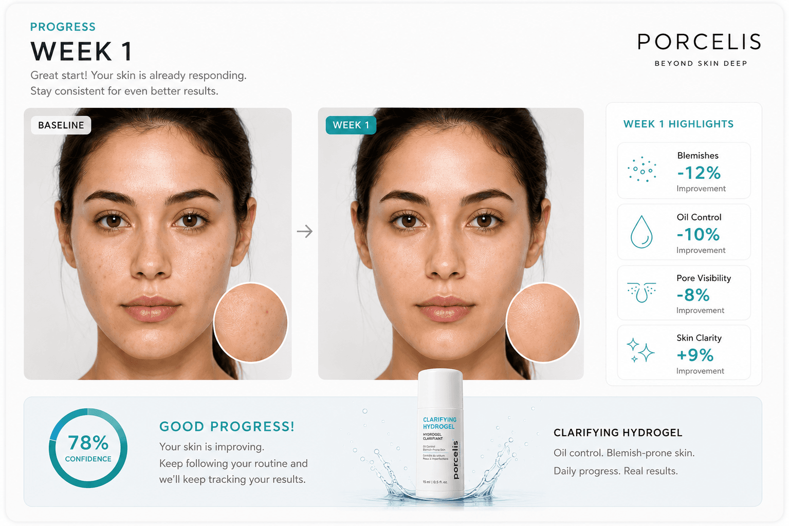 Sample Porcelis Week 1 progress report comparing a baseline scan with Week 1